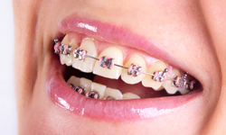 Understanding the Various Types of Braces Provided by Coastal Prosthetics  and Orthotics - Coastal